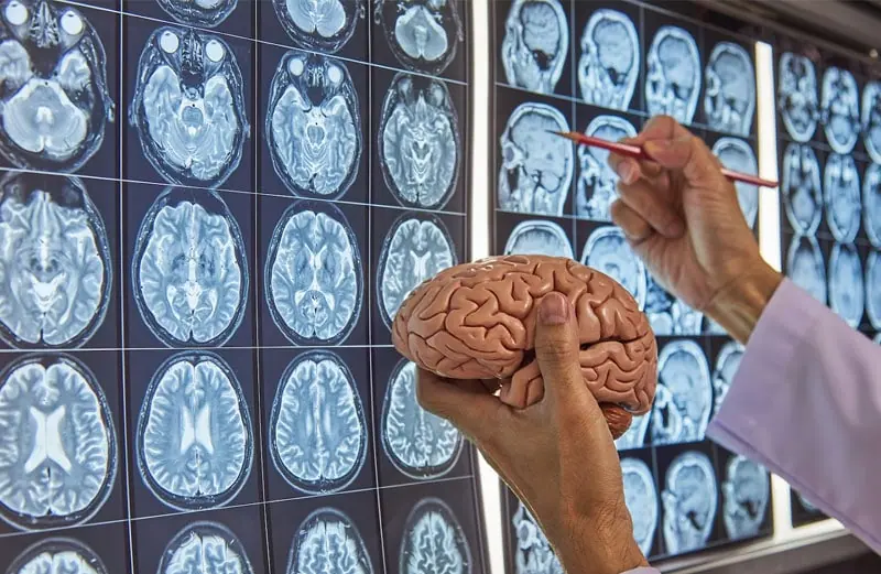 NEURO-SURGERY