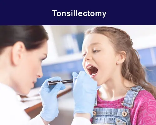 tonsil