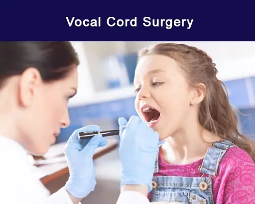 vocal
